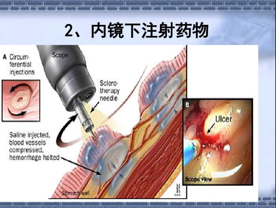 图片17.png